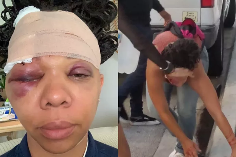 Image: LaToya Ratlieff was struck by a rubber bullet fired by a Fort Lauderdale police officer during a police brutality protest in 2020.